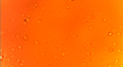 filter 2