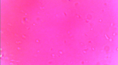 filter 1